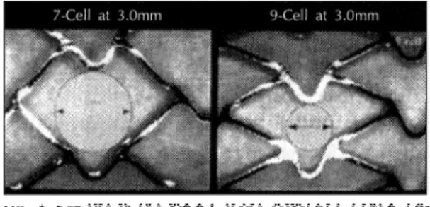 Fig. 1. A：Vertical loops of each cell allow high flexibi- flexibi-lilty by differential elongation during insertion(note the difference in the opening of the vertical loop inside(1) and outside(2) of the curve)