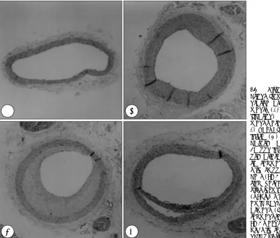 Fig. 1. Histological se- se-ctions from  represe-ntative arterial  seg-ments  (40   ×magn-ification)