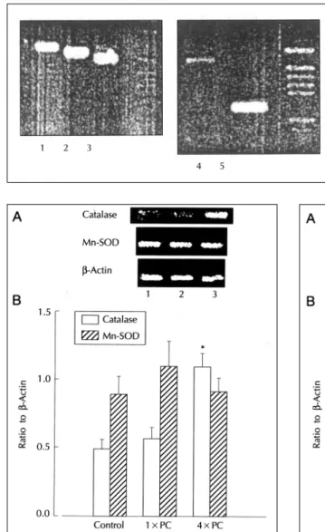Fig. 6. A) Representative photograph of interleukin-1 α and TNF-α gene products amplified by RT-PCR