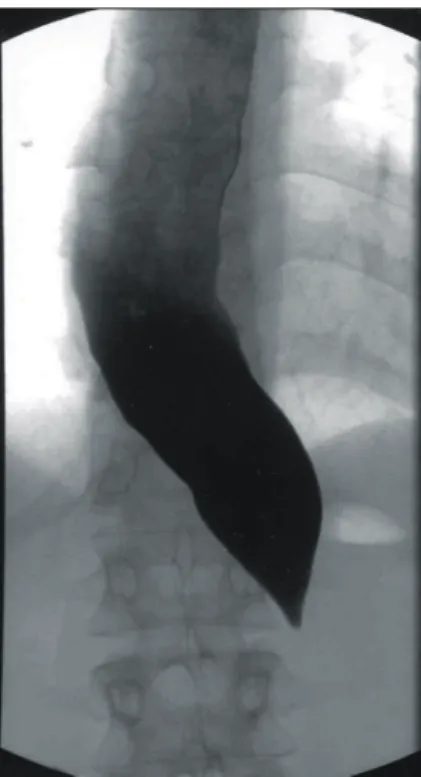 Fig. 3 Postoperative picture of operative wound. There are  small 5 scars on abdomen.