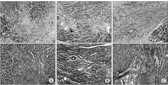 Fig. 8. Subendocardial neovascularization (black arrow) of MI only group is prominent