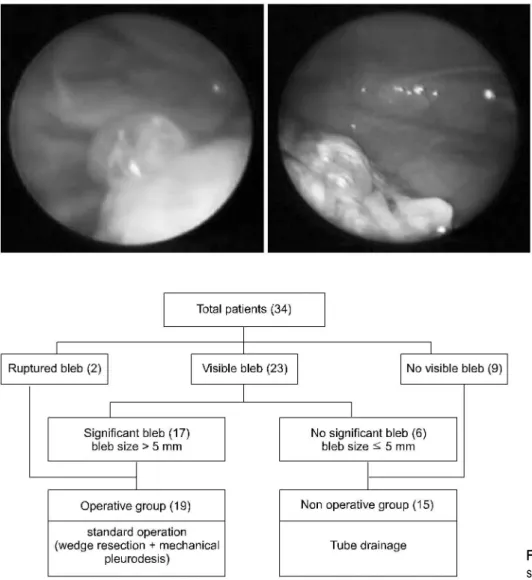 Fig. 3. Algorithm for treamtment of spontaneous penumothorax.
