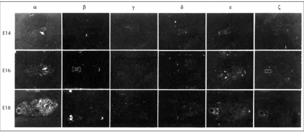 Fig. 2. Localization of PKC isoforms (α,  β,  γ,  δ,  ε and ζ) mRNA in the postnatal (P0, P7, P14, P21, adult) rat heart with in situ hybridization histochemistry