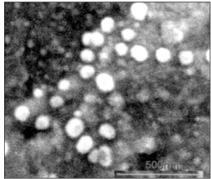 Fig. 2. Electron micrographs of liposome containing  17β-estradiol. The diameters of particles were less  than 200 nm (×68,000)