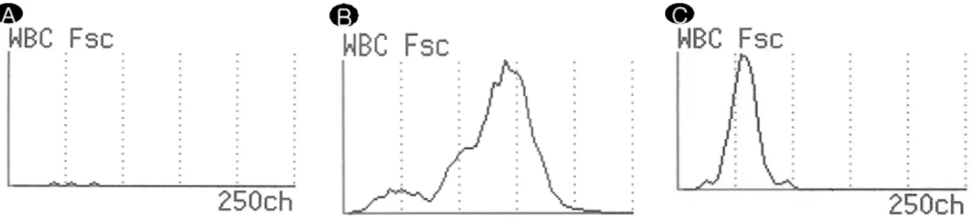 Fig. 5. Histogram of the Fsc intensity of WBC in UF-100. (A) Normal histogram (WBC count: 0/μL) (B) Peak is  detected  on  the  right  (differential  counts:  neutrophil  80%)  (C)  Peak  is  shift  to  the  left  (differential  counts: 