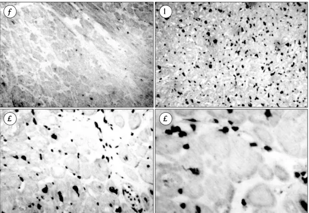 Fig. 8. Distribution pattern of cytomegalovirus genome among four chambers according to age in  cytomega-lovirus-positive cases