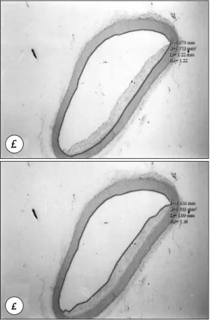 Fig. 1. Microscopic morphometry of foam cell infiltration  in intima of rabbit aorta (× 20 in light microscope)