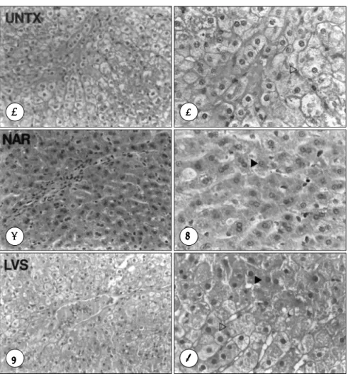 Fig. 2. Liver section of 1% cholesterol-fed rabbits that were untreated (A, B) or treated with naringin (C, D) or lovastatin (E, F)