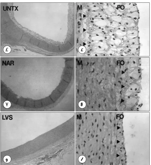 Fig. 3. Transverse section of aorta of 0.25% cholesterol-fed rabbits that were untreated (A, B) or treated with naringin (C, D) or lovastatin (E, F)