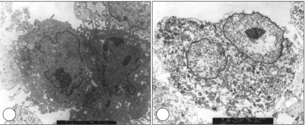 Fig. 9. Transmission electron microscopic findings of the vascular smooth muscle cells treated with lovastatin