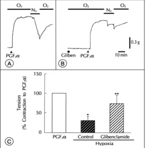 Fig. 15는 내피세포가 존재하지 않는 관동맥에서 K + ATP