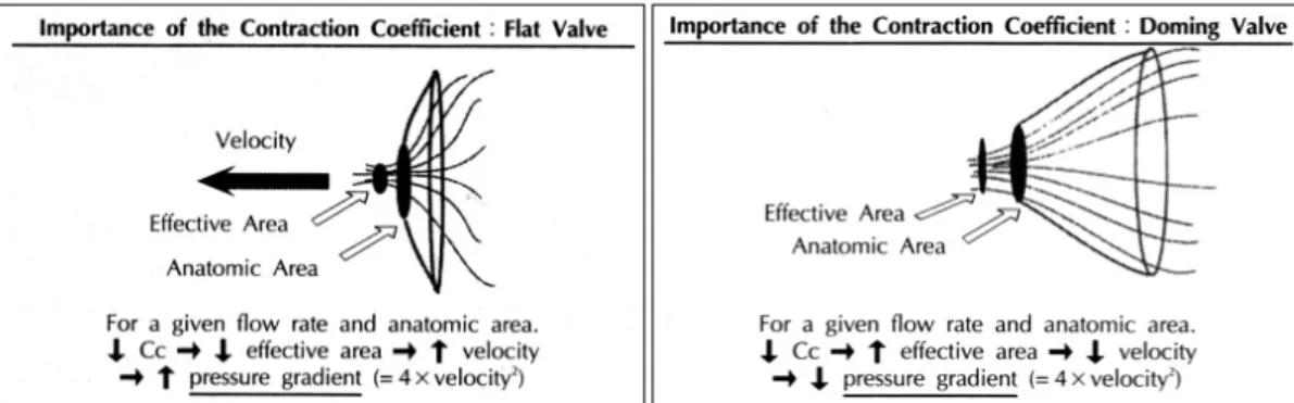 Fig. 7. A stenotic valve produce gradual convergence of flow both toward and beyond the limiting orifice, leading to a smaller effective orifice area and coefficient of contraction