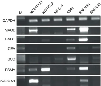 Fig. 1. Analysis of cancer antigen  gene expression in lung  and stomach cancer cell lines