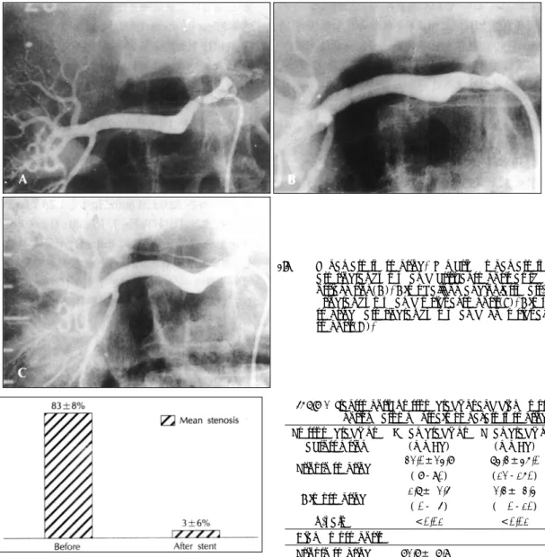 Fig. 1. Renal artery stenting. Selective renal artery arteriography revealed critical stenosis at the ostial lesion(A)