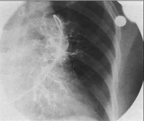 Fig. 4. Perfusion scans of the lungs from a variety of angles show normal findings. 