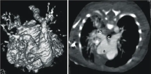 Fig. 2. Schematic drawing of operative view.