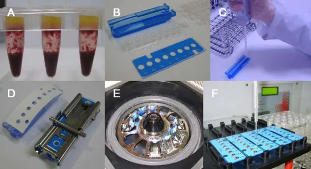 Fig.  1.  In-house  preparation  of  ANCA  slide.  A)  Overlay  method  to  separate  WBC