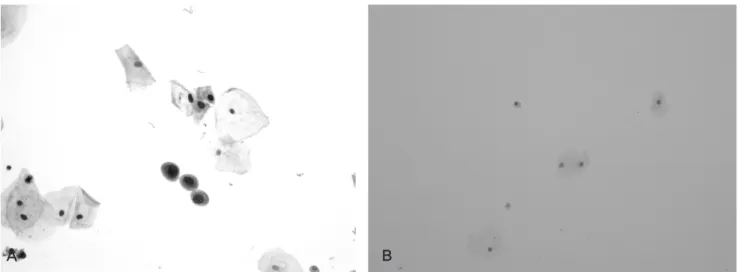 Fig. 3. ThinPrep® and conventional preparation cytology of a benign condition ("negative for malignancy")