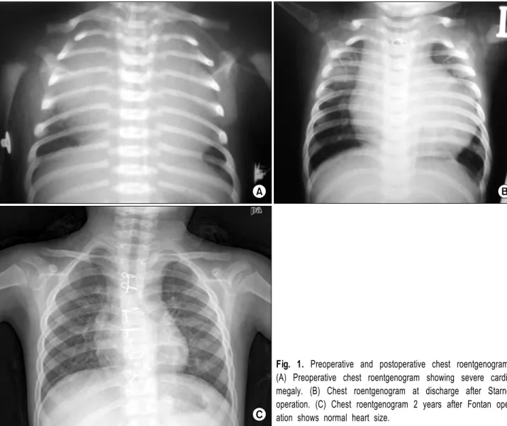 Fig. 1. Preoperative and postoperative chest roentgenograms. 
