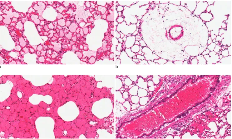 Fig. 4. Histologic section of rat’s lung tissues shows alveolar edema, perivascular edema, alveolar hemorrhage and bronchiolar hemorrhage (a: 3+ of alveolar edema in #18, H&amp;E, × 200 ;  b: 3+ of perivascular edema in #4, H &amp; E, × 200 ;  c: 3+of alve