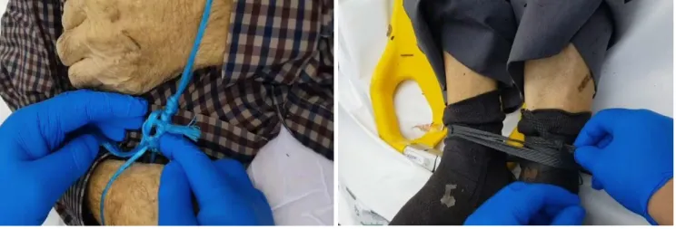 Fig. 3. Case 2. Lungs were hyperinflated (emphysema aquosum, A) and foamy fluid was exuded from bronchus (B)