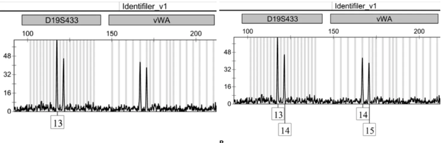 Table 2. Amount of DNA recovered from 15 donors with time- time-anticoagulant (heparin, EDTA) differences by two-way ANOVA