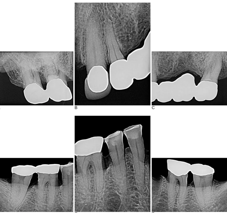 Fig. 3. There are no specific findings in the postmortem periapical radiographs. (A) The radiograph of the maxillary right first and second molars