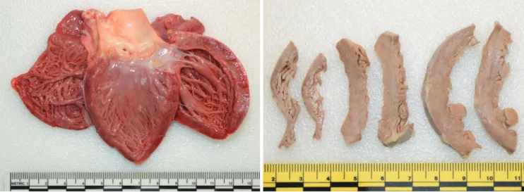 Fig. 1. Gross autopsy findings of the heart (A) with multiple areas of gray-whitish lesions on the cut surface after formalin fixation (B).