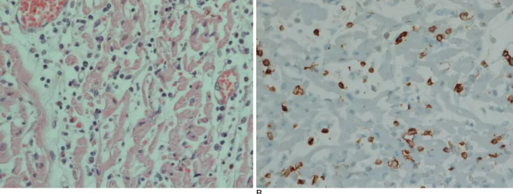 Fig. 3. Gross autopsy findings of three areas of intestinal intussusceptions in the small intestine without visible peritonitis (A), and one of the opened intussusceptions (lesions are indicated by arrows) (B).