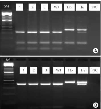 Fig. 1. Results of PCR-RFLP test for (A) factor V G1691A  and (B) prothrombin G20210A 1, 2, and 3: wild type  patients