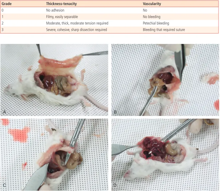 Fig. 2. The representatives of the each grade of intra-abdominal adhesion severity. (A) No adhesion (grade 0)