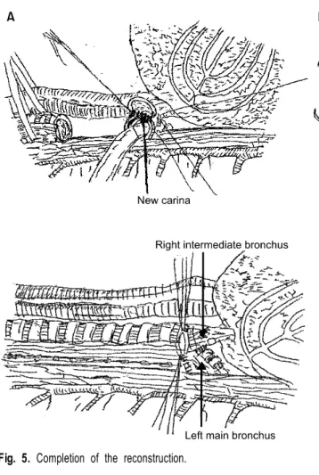 Fig. 5. Completion of the reconstruction.