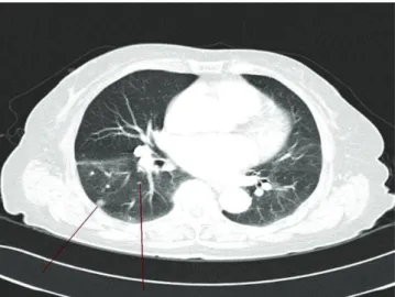 Fig. 5. Positron emission tomography-computed tomography imaging. 