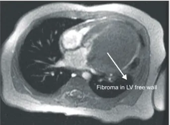 Fig. 3. Intraop. findings.