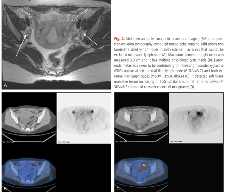 Fig. 2. Abdomen and pelvic magnetic resonance imaging (MRI) and posi- posi-tron emission tomography-computed tomography imaging