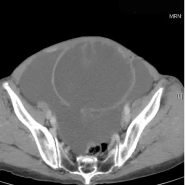 Fig. 3. Normal shaped appendix (H&amp;E, ×40).