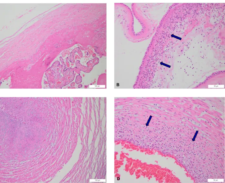Fig. 2. Histologic findings of normal chorioamnion, acute chorioamnionitis, normal umbilical cord and acute funisitis