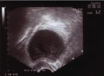 Fig. 2. Uterus after surgery and fi xation with formalin. 