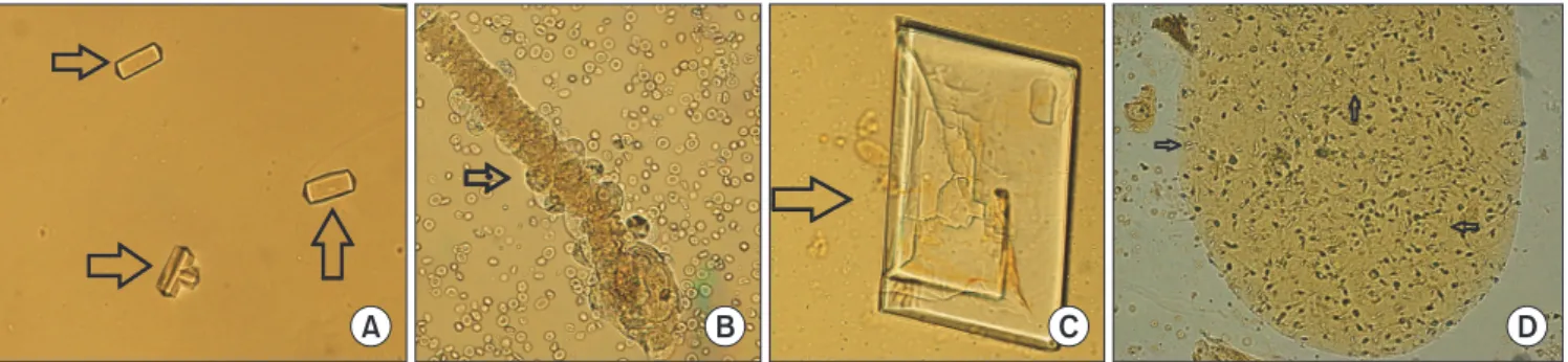 Fig. 1. Images of urine sediments (arrow) for external quality assessment. (A) CUI-18-01 calcium oxalate crystal (original mag- mag-nification×400)