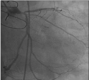 Table 2. Follow-up coronary angiography and reinterventions