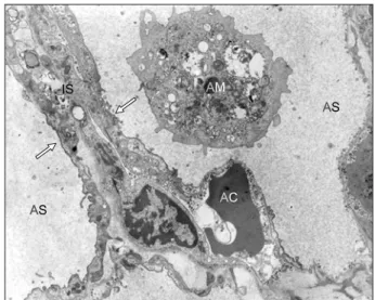 Fig. 7. Control group. Transmission electron micrograph shows alveolar collapse (arrows) and interstitial edema