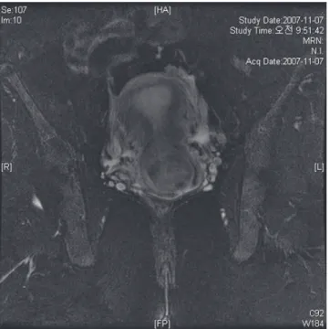 Fig. 3.  Gross fi ndings.