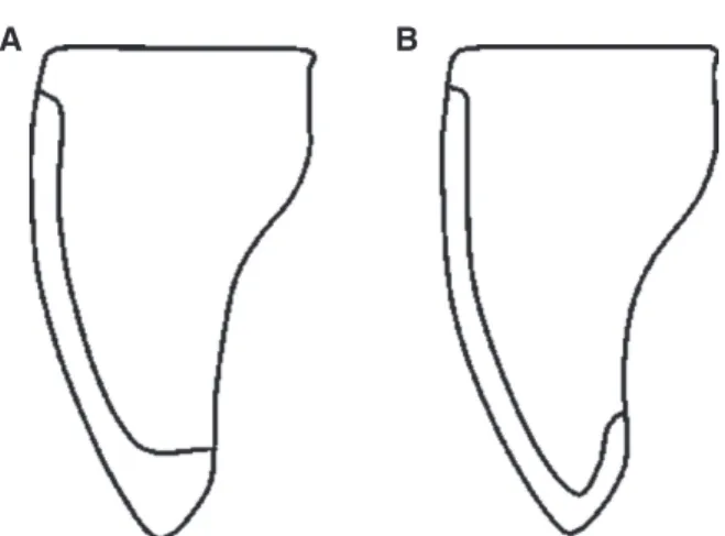 Fig. 1. Schematic diagram of specimen preparation. Butt  joint type (A), Palatal chamfer type (B).