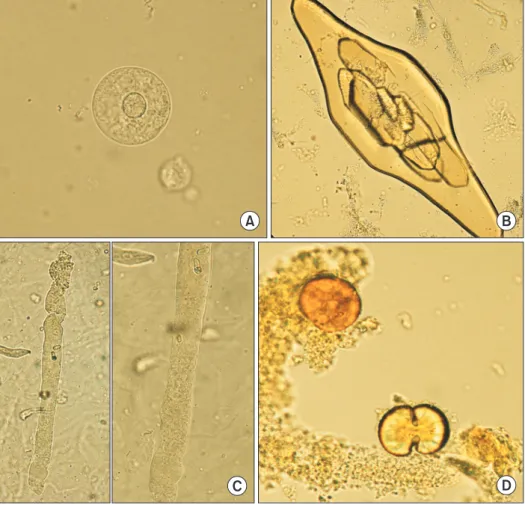 Fig. 2. Images of urine sediments  for external quality assessment. (A)  CUI-19-05 transitional epithelial  cells  (original  magnification×