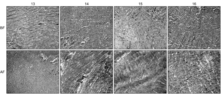 Fig. 4. H&amp;E stain of fixed bovine pericardium (×100). Decellularization (±)solvent (80% ethanol)