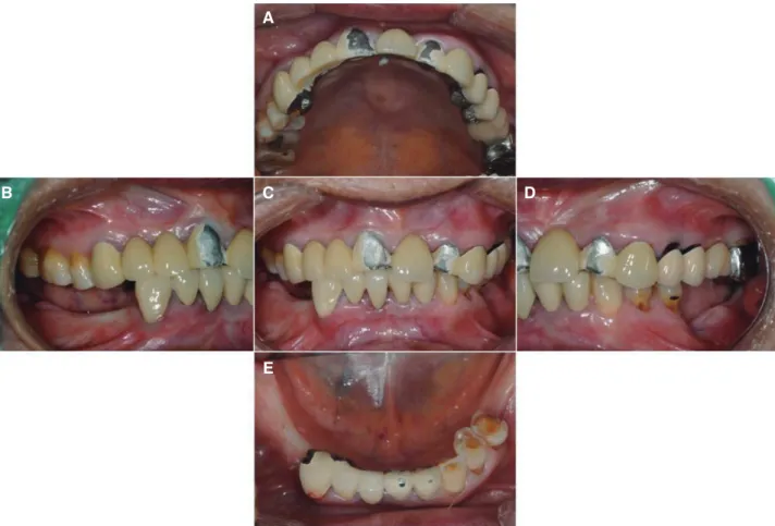 Fig. 2. Pre-treatment panoramic radiograph. 
