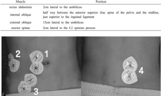Fig  1.  Electromyography  position.  1:  rectus  abdominis,  2:  external  oblique,  3:  internal  oblique,  4:  erector  spinae.