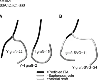 Fig. 1. Conduct of composite graft in group I as a 2nd (A) or  3rd (B) graft. SVG=Saphenous vein graft; ITA=Internal thoracic  artery.