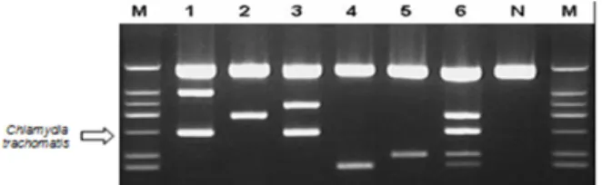 Fig. 1. Species-specific DNA amplification by multiples polymerase chain reaction in clinical specimens