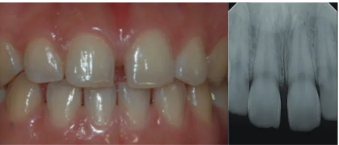 Fig. 1. Preoperative photograph and radiograph.